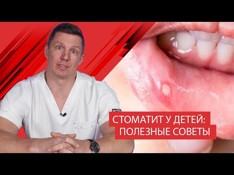 Видео: Стоматит у детей: полезные советы