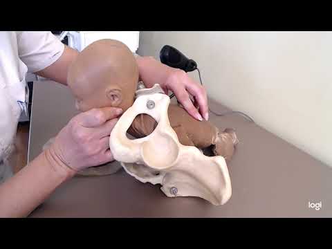 Видео: Затылочное предлежание передний вид