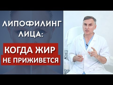 Видео: ЛИПОФИЛИНГ ЛИЦА: КОГДА ЖИР НЕ ПРИЖИВАЕТСЯ⁉️