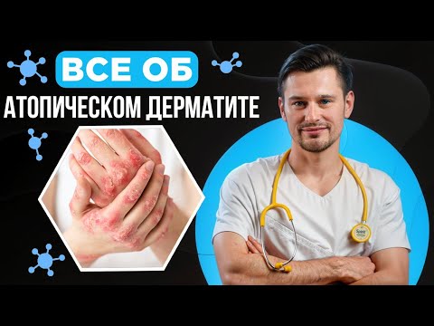 Видео: Атопический дерматит у детей: правда, лечение и ошибки родителей | Антон Тещенков