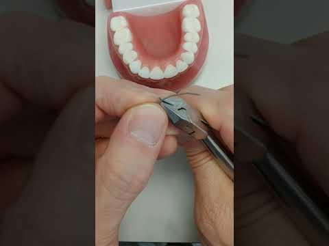 Видео: Техника использования фиксированного ретейнера на верхней челюсти