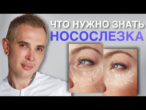 Видео: НОСОСЛЕЗКА что нужно знать? #носослезка