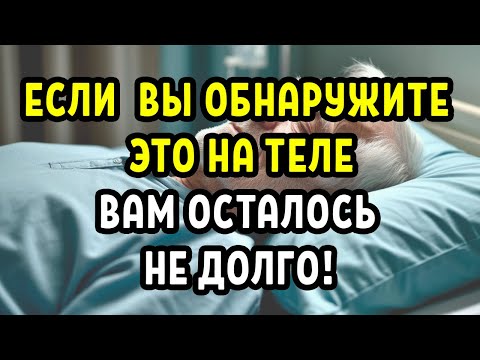 Видео: Если на теле пожилого человека вдруг появляется это, готовьтесь к худшему…