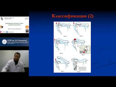 Видео: Повреждения плечевого пояса и верхней конечности.