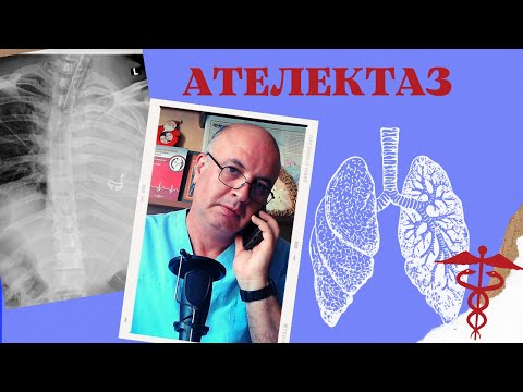 Видео: АТЕЛЕКТАЗ - это коллапс легочной ткани с потерей объема легкого