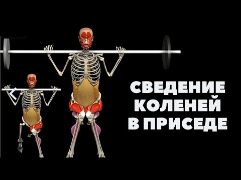 Видео: СВЕДЕНИЕ КОЛЕНЕЙ В ПРИСЕДАНИЯХ