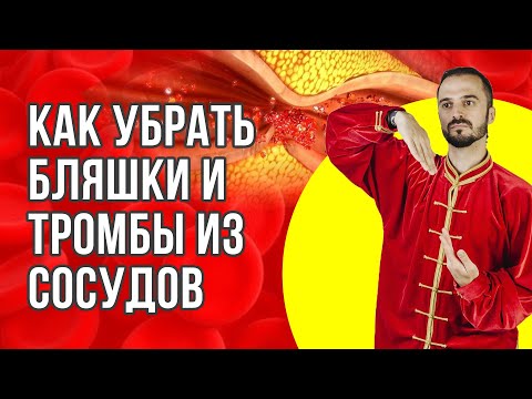 Видео: Как очистить сосуды от холестериновых бляшек, тромбов? Как восстановить работу сосудов и вен?