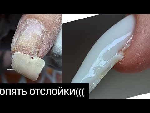 Видео: ПОЧЕМУ у меня ВСЕГДА ОТСЛОЙКИ ?