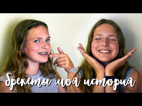 Видео: Брекеты моя история Это больно?