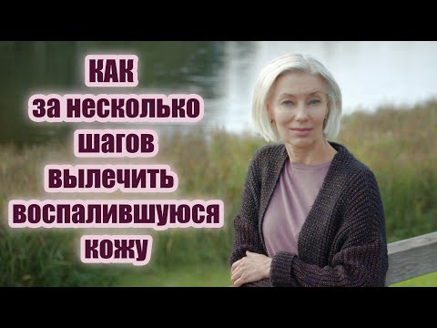 Видео: ☆КАК за НЕСКОЛЬКО ШАГОВ вылечить воспалившуюся кожу☆Моя пошаговая система