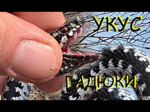 Видео: Укусила гадюка. Что делать?