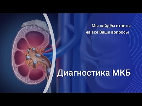 Видео: Диагностика МКБ
