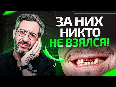 Видео: Самые ужасные ЗУБЫ! От ЭТИХ пациентов отказались ВСЕ, кроме нас...
