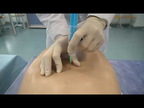 Видео: ПСА Цистостомия под ультразвуковым контролем Урология