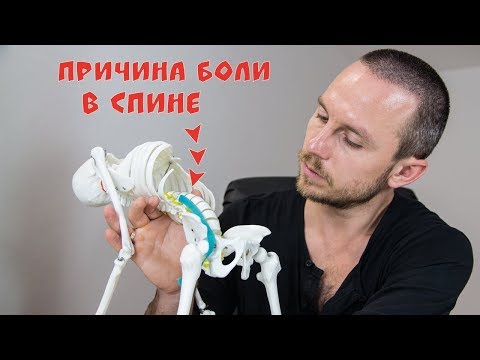 Видео: БОЛИТ СПИНА в области поясницы 🔴 Триггерные точки в подвздошно-поясничной мышце (ППМ)