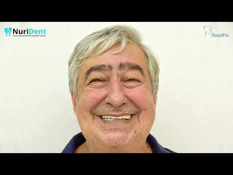 Видео: Владимир е 8 години с базални импланти: Аз не съм срещал на Земята такъв специалист, като Д-р Нури