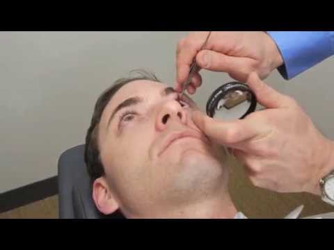 Видео: Учебное пособие по склеральной депрессии