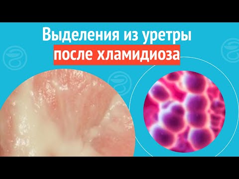 Видео: 😧 Выделения из уретры после хламидиоза. Клинический случай №1526