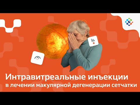 Видео: Возрастная макулярная дегенерация сетчатки глаза. Применение интравитреальных инъекций в лечении.