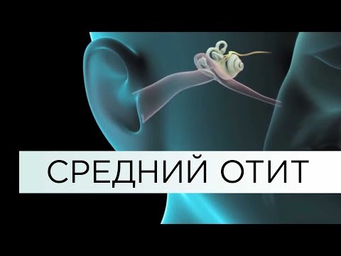 Видео: СРЕДНИЙ ОТИТ