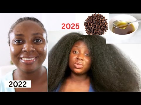 Видео: Ваши проплешины исчезнут всего через 2 недели использования! Быстро делает волосы гуще!