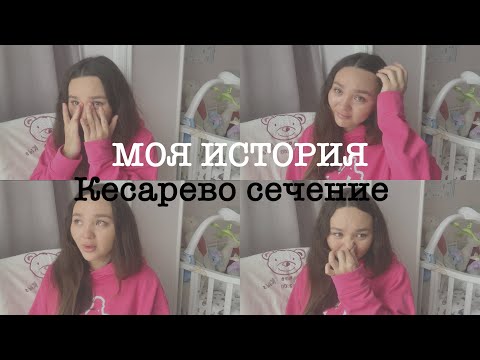 Видео: МОИ РОДЫ : Моя история / кесарево сечение