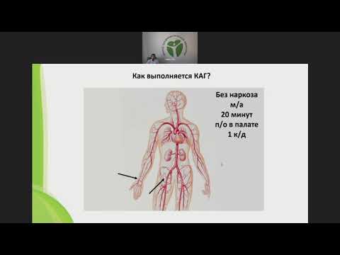 Видео: Определение показаний к проведению коронарной ангиографии в практике врача первичного звена