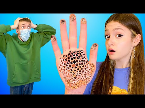 Видео: ЗАБОЛЕЛА СЕРЬЕЗНОЙ БОЛЕЗНЬЮ! Как не заразить друга?!