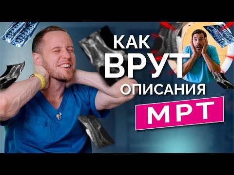 Видео: Грыжа в шее: почему СТРАШНОЕ ОПИСАНИЕ МРТ не имеет к вам никакого отношения