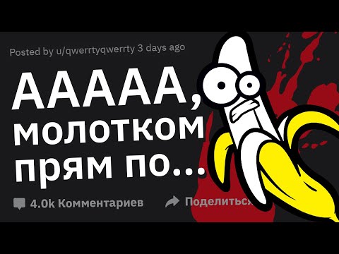 Видео: Худшая Физическая БОЛЬ в Вашей Жизни 🤬