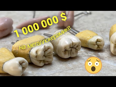 Видео: Ответы на вопросы зубнику. 1 000 000 $  на металлокерамике  😂  .   Зубной техник