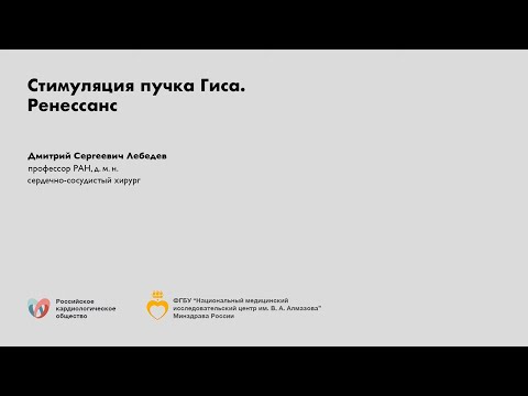 Видео: Стимуляция пучка Гиса. Ренессанс