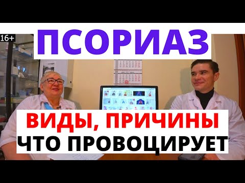 Видео: Псориаз - причины, диагностика, лечение, питание при псориазе. Что провоцирует псориаз?