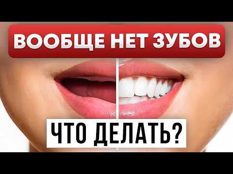 Видео: Во рту НОЛЬ ЗУБОВ. Что делать? Реальный план возвращения к жизни