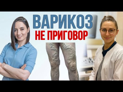 Видео: Всё про варикоз, тромбоз, проблемы с венами, отеки, здоровье сосудов и НЕ ТОЛЬКО | Врач Флеболог