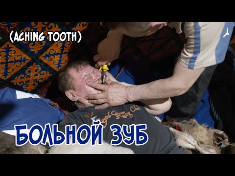 Видео: Великий кочевник Няду. Больной зуб.