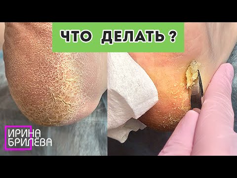 Видео: Когда ПЕДИКЮР пошёл...  не по плану 🌸 Ирина Брилёва