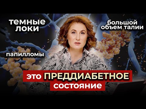Видео: ОЧЕНЬ ОПАСНЫЕ ПРИЗНАКИ: распознай инсулинорезистентность!