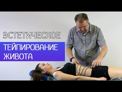 Видео: Тейпирование живота от целлюлита. Абдоминальный целлюлит.