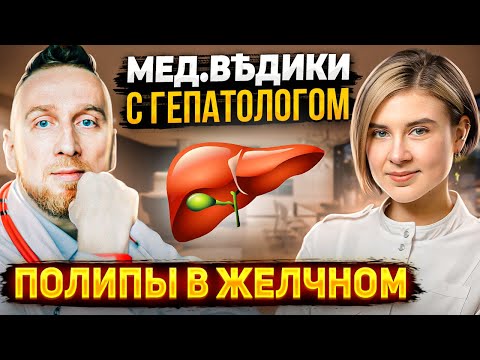 Видео: Полипы желчного пузыря || Какой полип может стать раком