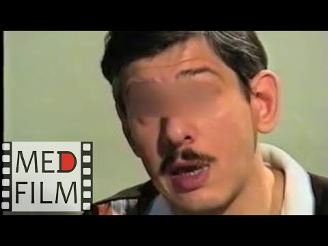 Видео: Слабоумие. Поведение в быту. Менингоэнцефалит в детстве © meningoencephalitis,dementia