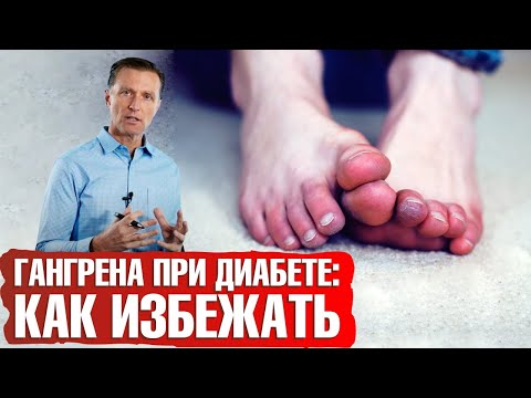 Видео: Гангрена при сахарном диабете: профилактика и лечение гангрены