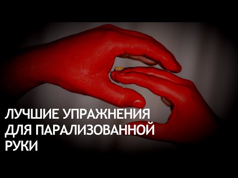 Видео: Упражнения для руки парализованной после инсульта. 12 лучших.