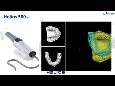 Видео: Порівняння інтраоральних 3D сканерів Helios 500 та Helios 680