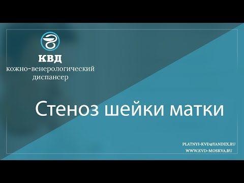 Видео: 1042  Стеноз шейки матки