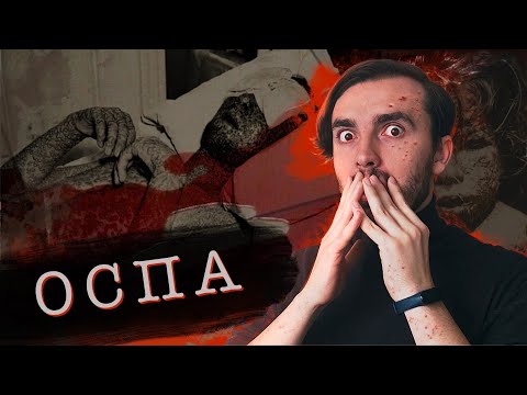 Видео: Чёрная Оспа - [История Медицины]