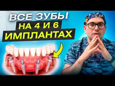 Видео: Как Восстановить ЗУБЫ Недорого? Система "Всё на 4" и "Всё на 6" - Ваша Новая Улыбка