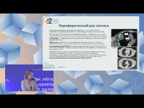 Видео: Шивилова - Совеременные возможности радиотерапии в лечении начальных форм рака легкого