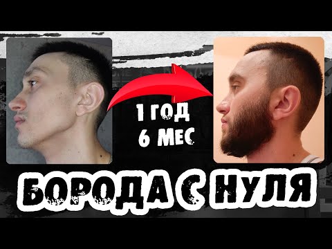 Видео: Капиксил М для роста бороды курс 1 год и 6 месяцев / Выпуск 46 / Андрей Борода
