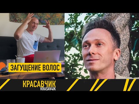 Видео: Пересадка волос для загущения. 4200 графтов на перед. Кейс с блогером (Антон Соколов) \ Красавчик